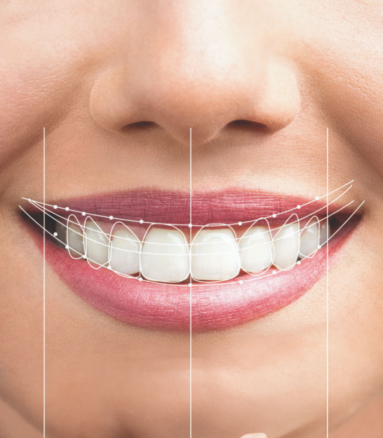 Estetica Dentale